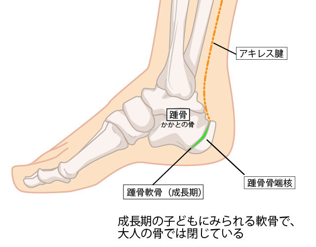 踵のイラスト